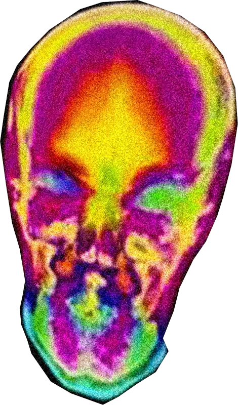 Cabeça em scan térmico psicodélico